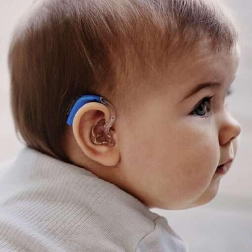 Bébé appareillé avec un contour d'oreille pédiatrique bleu